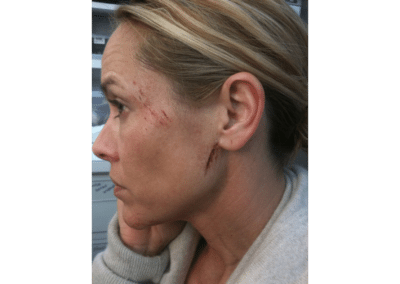 Maria Bello (Bruised Face) - Prime Suspect